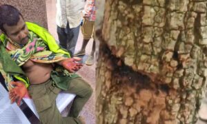 1759457107 Chenchu man attacked for exposing poaching in forests of Telangana