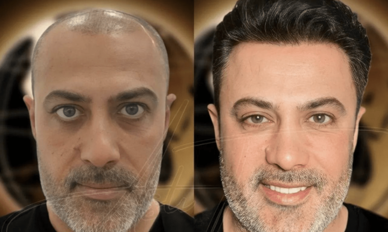 1761150423 Expert Clinics – Hollywood Life
