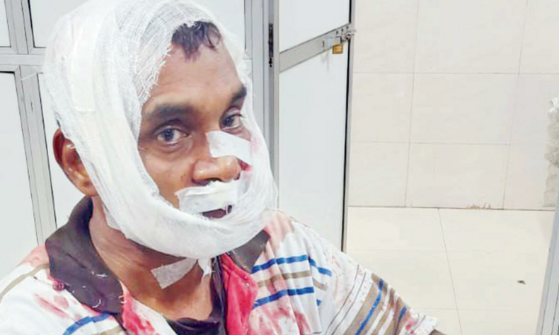 Mumbai Man slashed with knife chopper for resisting phone snatching