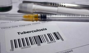 India logged highest number of TB cases in 2024 WHO